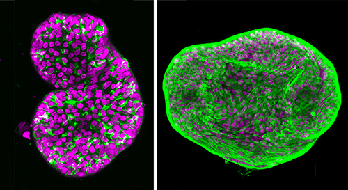Image showing two organoids developed as a prostate cancer model